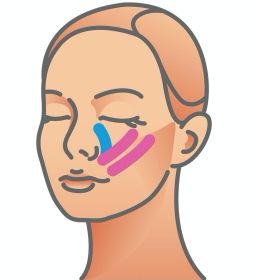 facetaping, plastrowanie twarzy